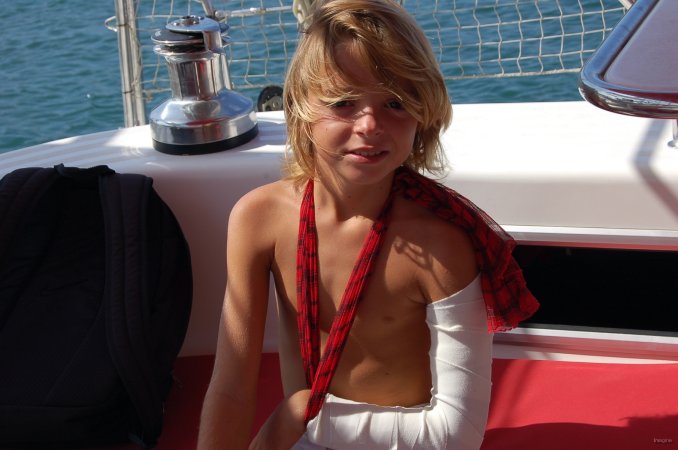 53- Carla bien courageuse avec son bras casse 